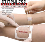 EVERLIT Wound Closure Kit | Surgical Zip-Stitch Devices - Image 3